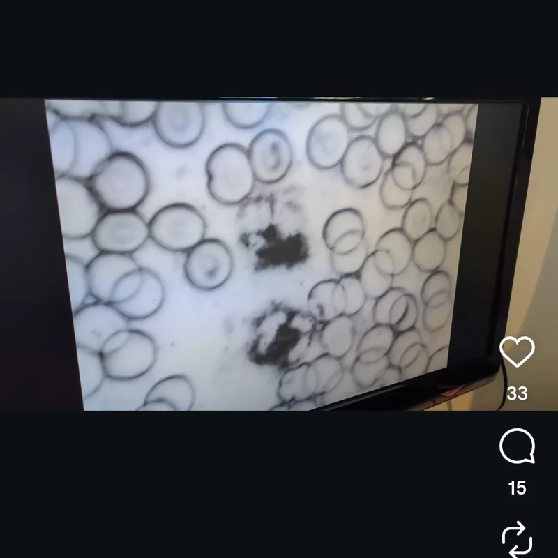Homeschool science lesson, microscopic view on screen